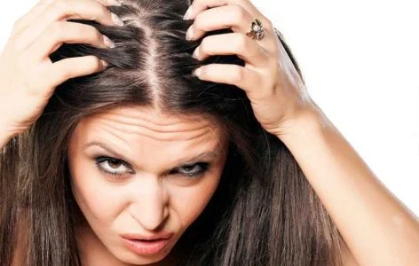 علت های خارش پوست سر