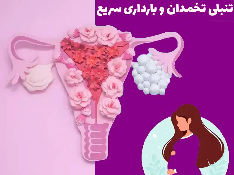 برای تنبلی تخمدان و بارداری سریع چیکار کنیم؟