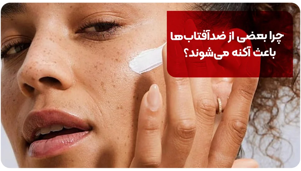 چرا بعضی از ضدآفتاب&zwnj;ها باعث آکنه می&zwnj;شوند؟