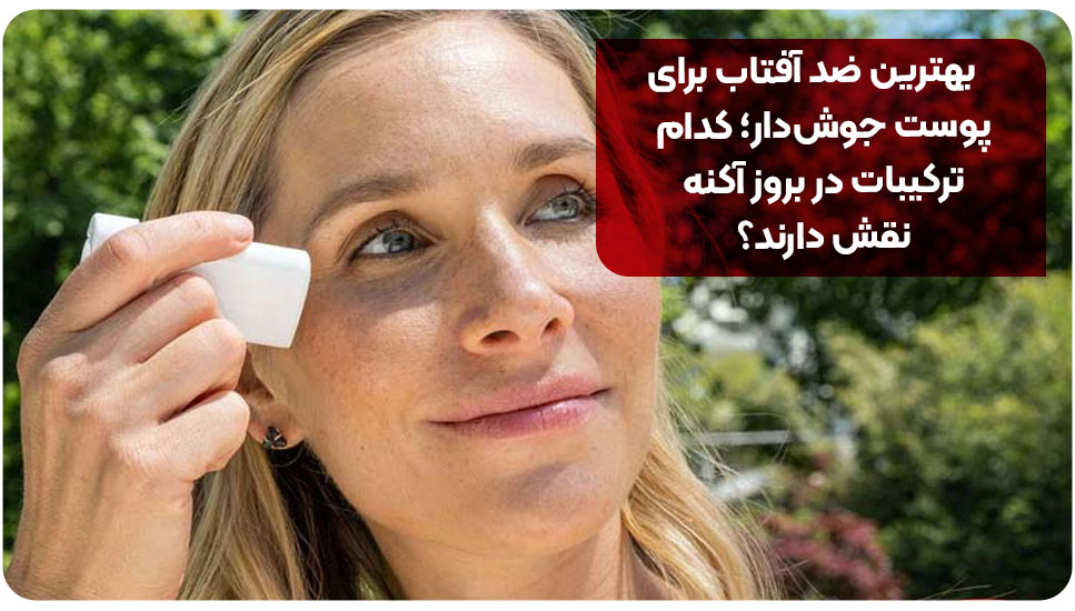 بهترین ضد آفتاب برای پوست جوش‌دار؛ کدام ترکیبات در بروز آکنه نقش دارند؟