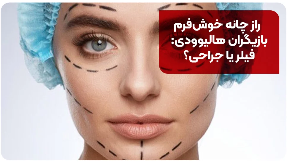 راز چانه خوش‌فرم بازیگران هالیوودی: فیلر یا جراحی؟