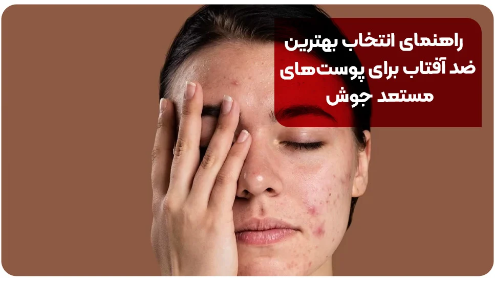 راهنمای انتخاب بهترین ضد آفتاب برای پوست‌های مستعد جوش