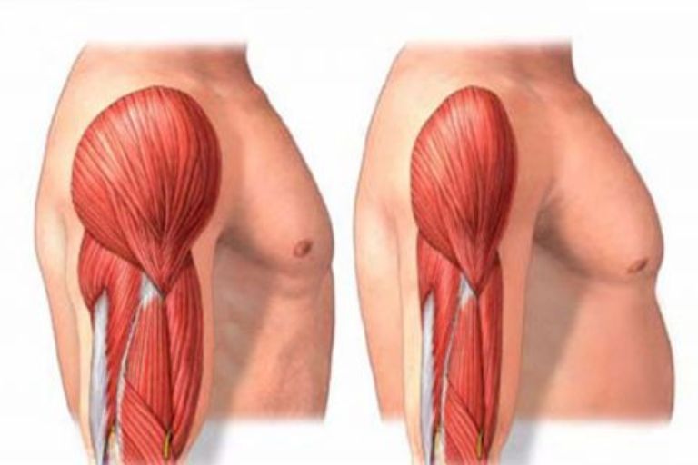 راه های بازسازی عضلات تحلیل رفته و جلوگیری از تحلیل آن ها