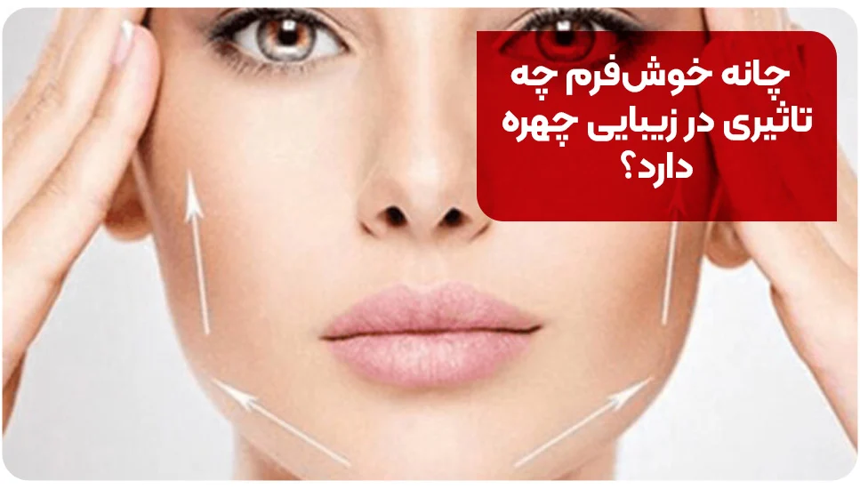 چانه خوشفرم چه تاثیری در زیبایی چهره دارد؟