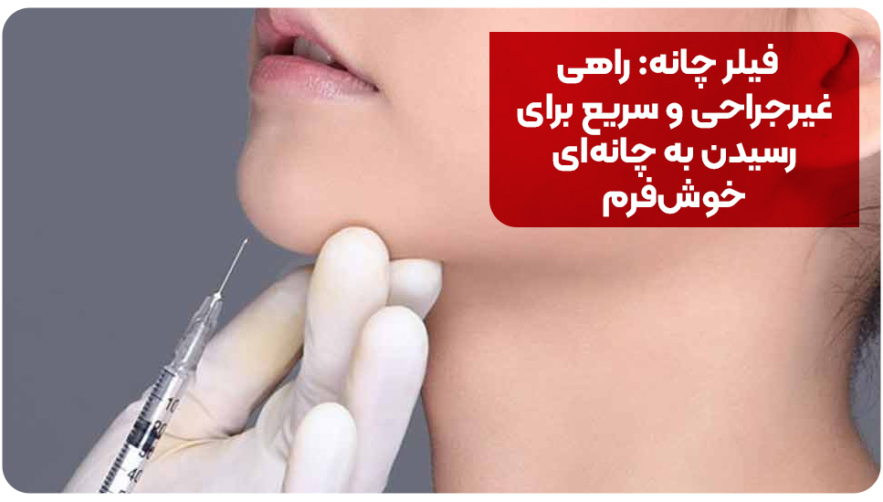 فیلر چانه: راهی غیرجراحی و سریع برای رسیدن به چانهای خوشفرم