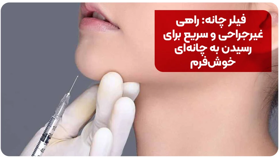 فیلر چانه: راهی غیرجراحی و سریع برای رسیدن به چانهای خوشفرم